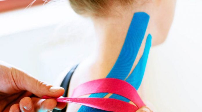 В чем польза кинезиотейпирования